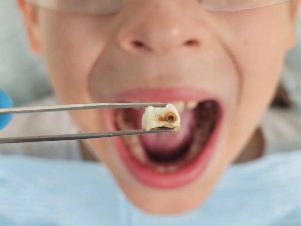 Best Broken Tooth Emergency  in Starke, FL