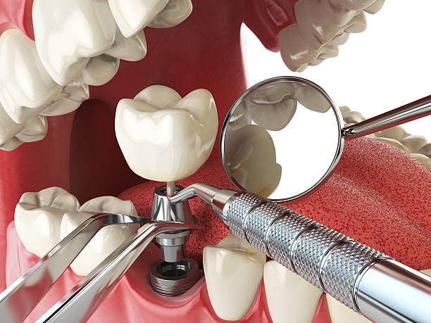Best Root Canal Emergency Dentist  in Starke, FL